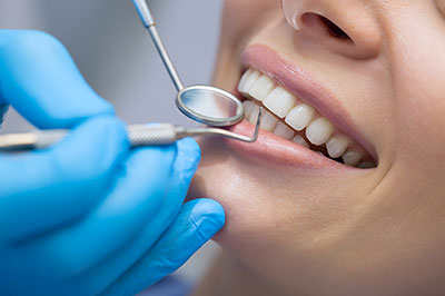 An image of a dental professional performing oral care on a patient, with the patient s mouth open and the professional using dental instruments.