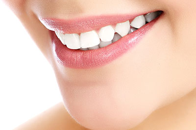 A close-up of a smiling person showcasing teeth whitening results.