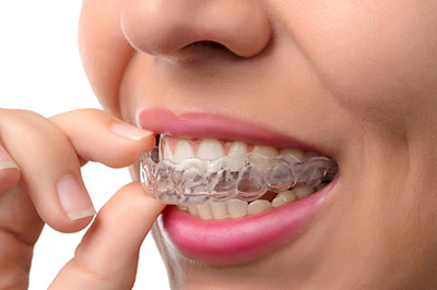 The image shows a person with straight, white teeth wearing a clear aligner or orthodontic appliance, and their hands are holding the aligner in place.