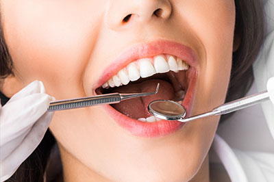 Woman s smiling face with teeth being cleaned by dental instruments.