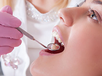 A dental professional performing a dental procedure on a patient s mouth, with the patient wearing a purple surgical gown and having their mouth open.