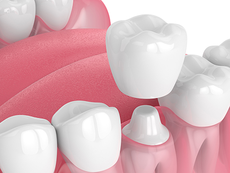 Kreitzberg Dental